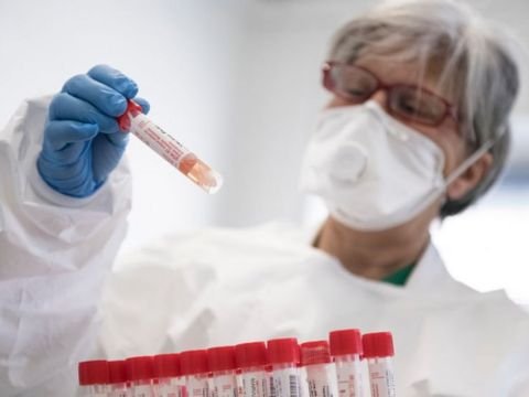 ÜST pandemiyanın bitəcəyi tarixi AÇIQLADI