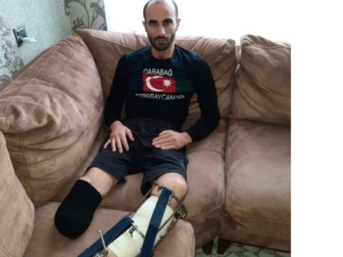 Hər iki ayağımı itirən qaziyə niyə 3-cü qrup əlillik verilib?