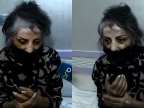 Əməkdar artist Zöhrə Abdullayeva xəstəxanaya yerləşdirildi