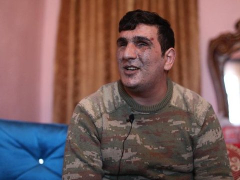 Cəsur döyüşçülər - Hər iki gözünü itirən əsgər: “Azacıq ümid var, mənə kömək göstərilsin” - FOTOLAR