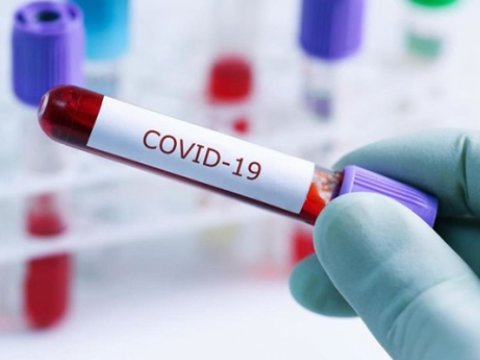 Azərbaycanda kim daha çox koronavirusa yoluxur: kişilər, yoxsa qadınlar?