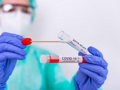 Koronavirus Azərbaycanda bu gün -  STATİSTİKA