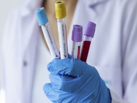 Rusiyada koronavirusa yoluxanların sayı açıqlandı