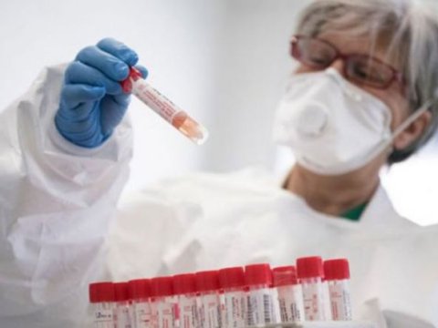 Azərbaycanda yoluxma 61-ə düşdü - 2 nəfər öldü