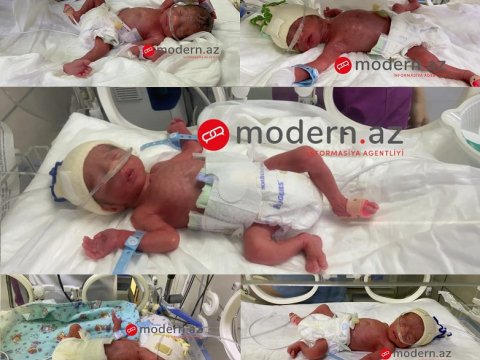 Beşəm doğulan ailəyə hansı güzəştlər veriləcək? - Nazirlik AYDINLIQ GƏTİRDİ