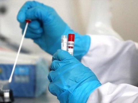 Bu günün yoluxma sayı açıqlandı