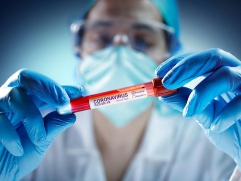 Azərbaycanda yoluxanlar yenə sağalanları üstələdi