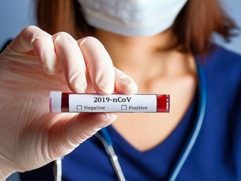 Yoluxan azaldı, sağalan çoxaldı, ölən olmadı  