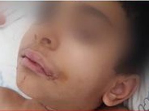 Daxili işlər naziri və Baş prokuror 5 yaşlı uşağın işini nəzarətə götürdü