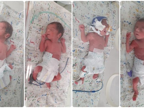 Dördəmlərin xəstəxana xərclərini bu qurum ödədi