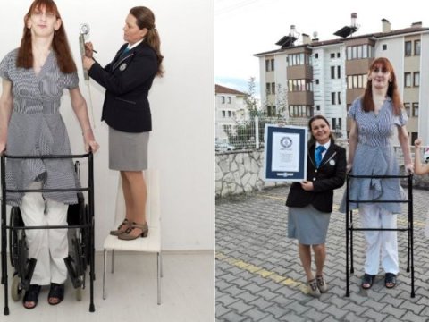 Dünyanın ən uzun qadını Türkiyədədir