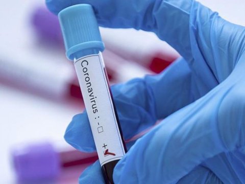 Azərbaycanda koronavirusa qarşı kollektiv immunitet nə vaxt yaranacaq?