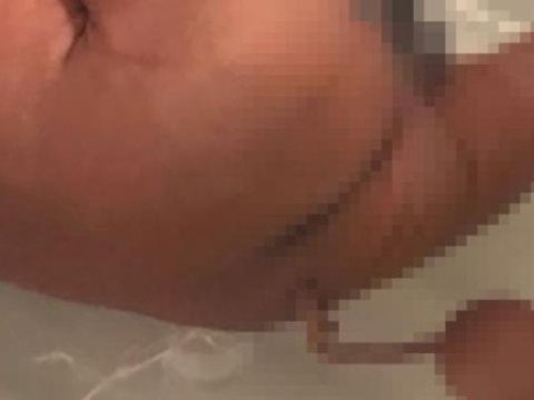 Braziliyada quyruqlu körpə doğuldu
