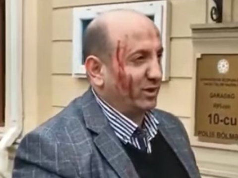 “Sədərək”də yeni axunda etiraz edən şəxs HƏBS EDİLDİ
