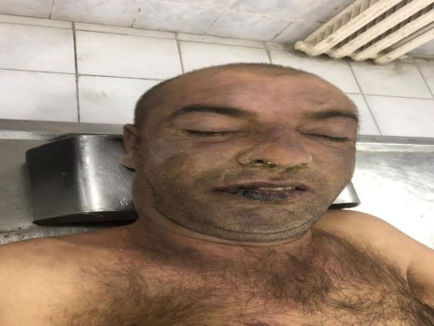 Xızıda naməlum kişi meyiti tapılıb - FOTO