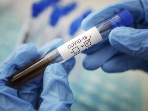 Son sutkada yoluxanlar - 18 ÖLÜM