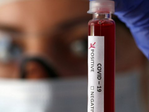 Ermənistanda virus statistikası