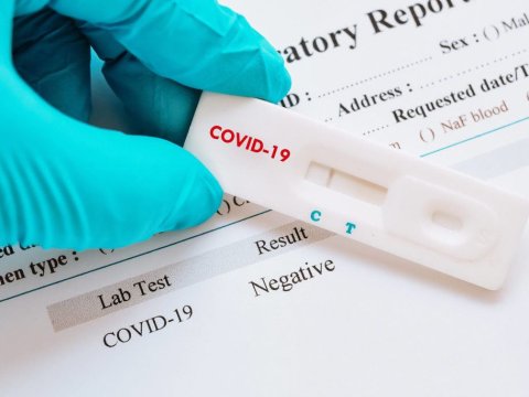 Azərbaycanda koronavirus testi istehsal olunur