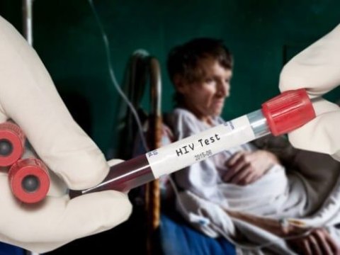 Bu il 654 nəfər İİV-ə YOLUXUB