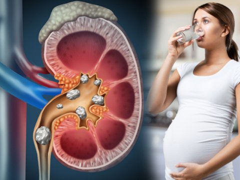 Böyrək çatışmazlığı ilə uşaq dünyaya gətirmək şansı aşağıdır