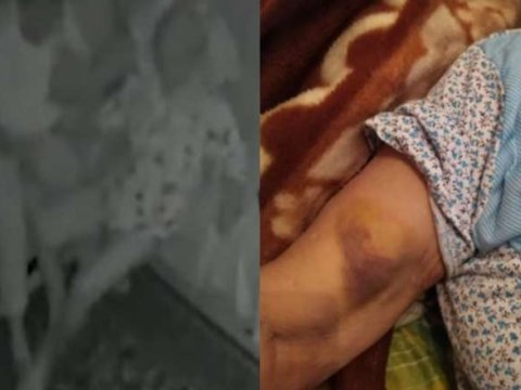 Xəstə qadını döyən baxıcıya cinayət işi açıldı