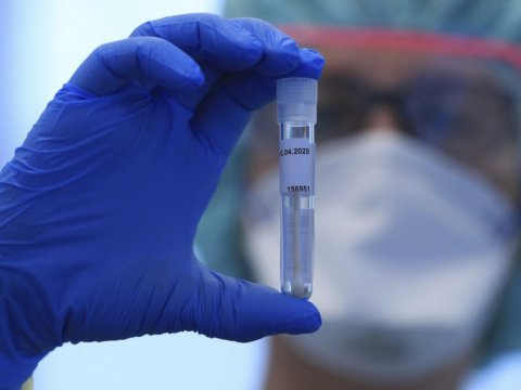 Daha bir ölkədə “Omicron”