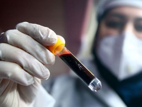 Son sutkada yoluxanlar - 503 nəfər SAĞALDI