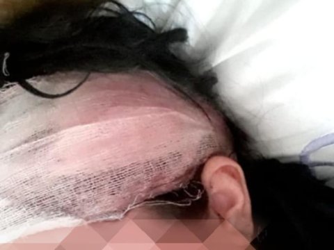 İki uşaq anası əri və qayınanası tərəfindən amansızcasına döyüldü - FOTO