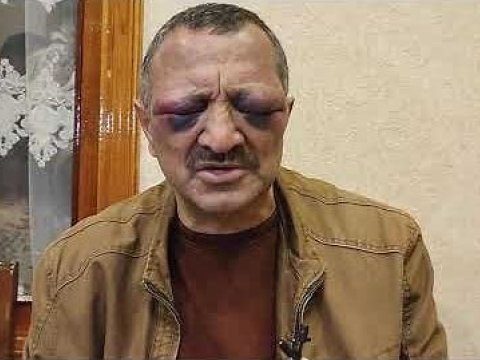 Tofiq Yaqublunun döyülməsi ilə bağlı araşdırma YEKUNLAŞDI