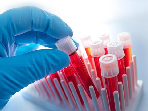 Vegeterianlar arasında anemiyalılar çoxdu