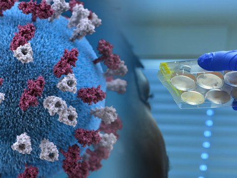 Ermənistanda virusdan ölənlər 8 mini ötdü