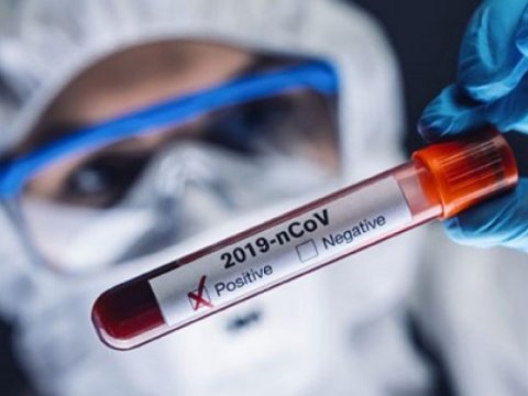 Bu gün yoluxanların sayı: 369 nəfər sağaldı