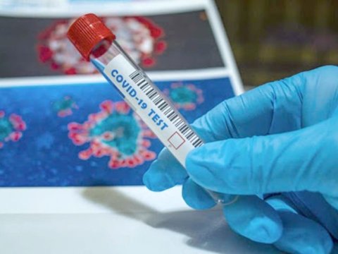 Rusiyada virusa yoluxma sayı 11 milyonu ötüb 