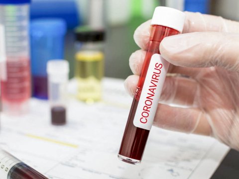Yoluxma artır - Səhiyyə qurumlarından koronavirus ÇAĞIRIŞI