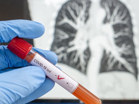 COVID daha yüngül virusa çevriləcək