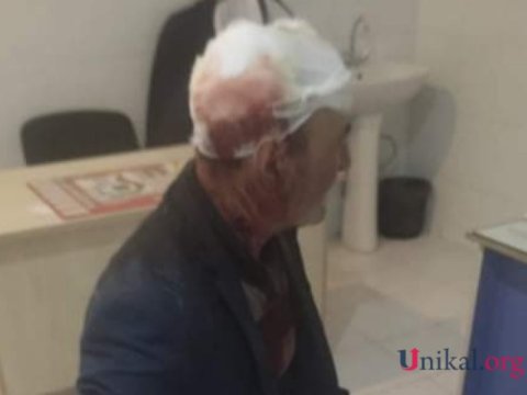 Gəncədə yaşlı kişini baltaladılar