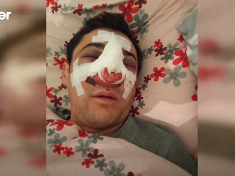 Bakıda avtobus sürücüsü döyüldü - Anbaan VİDEO