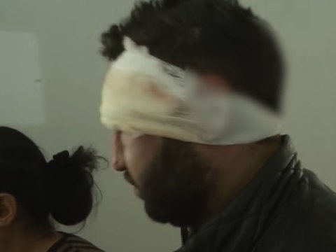 25 yaşlı gəncin qulağının kəsilməsinin təfərrüatı - VİDEO
