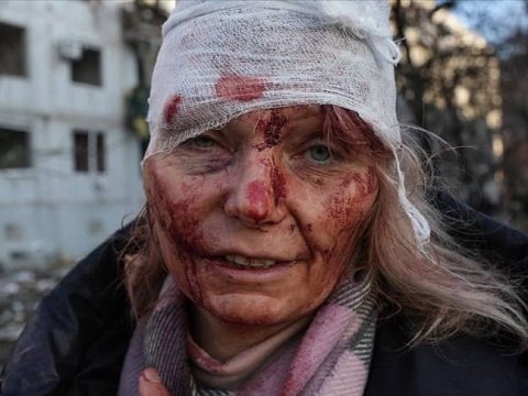 Rusiya-Ukrayna müharibəsinin simvolu: “Putinə təslim olmaqdansa, ölmək yaxşıdır” - Dünya ondan danışır