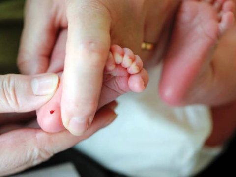 Azərbaycanda körpələrdən topuq testi götürülür