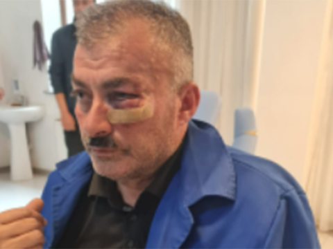 Borclu abonent “Azəriqaz”ın əməkdaşını döydü - FOTO