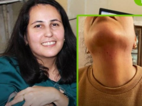 Bakıda jurnalistə hücum edildi - FOTO