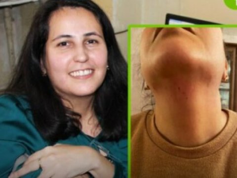 “Aytənə edilən hücum detallarına qədər planlaşdırılıb” - Jurnalistin həyat yoldaşı