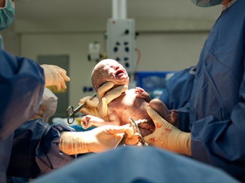 Doğuşa görə 600 manat tələb edilməsi iddiasına TƏBİB-dən CAVAB