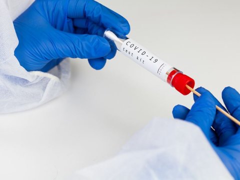 Xəstəxanalarda COVID testi tələbi ləğv olundu