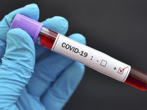 Gündəlik COVID statistikasına nə ehtiyac var? - AÇIQLAMA