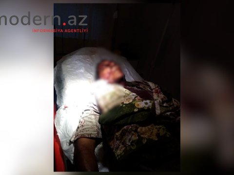 Ağsuda çobanı canavar parçaladı - FOTO