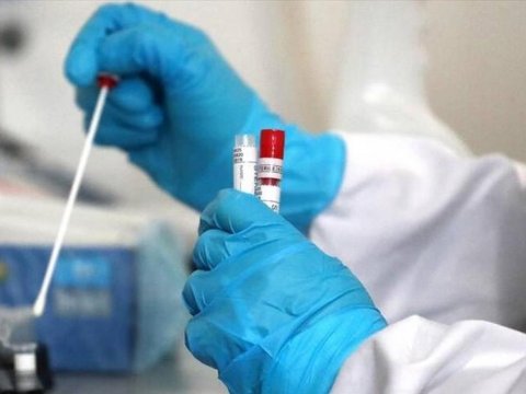 Gündəlik yoluxma statistikası insanlara maraqlı deyil - DEPUTAT