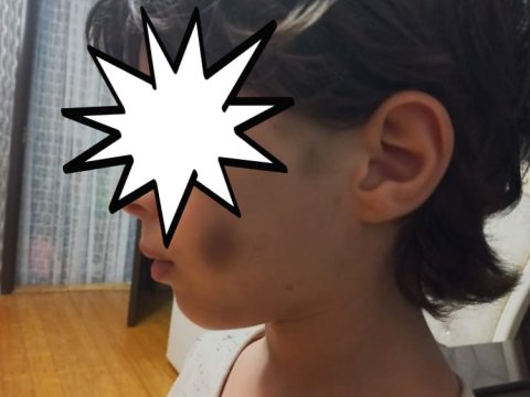 3 bacı anasının sevgilisi tərəfindən döyülüb - FOTOLAR