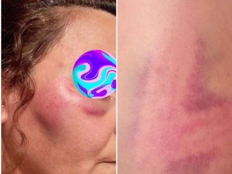 Döyülən qadının əri əmisi oğlu imiş - YENİLƏNİB